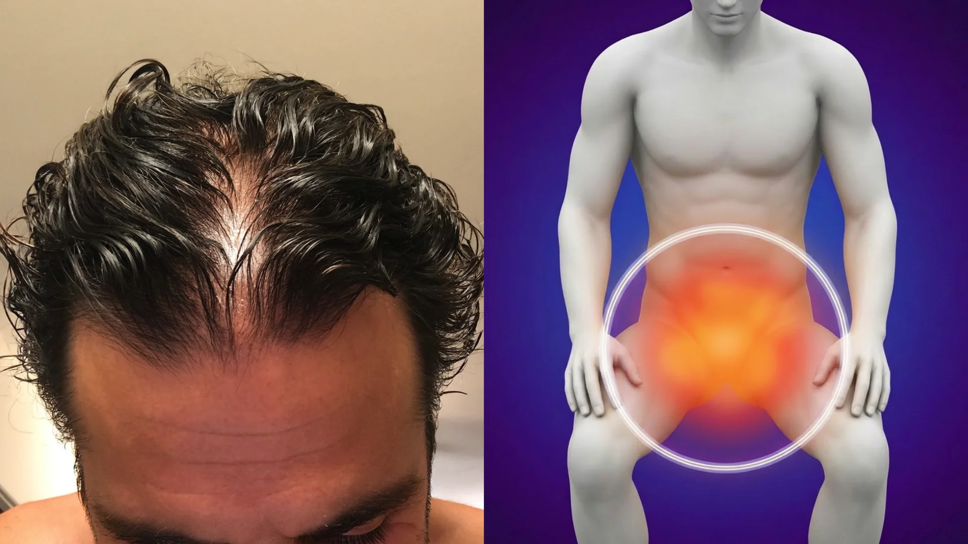 Hair transplant result comparison
